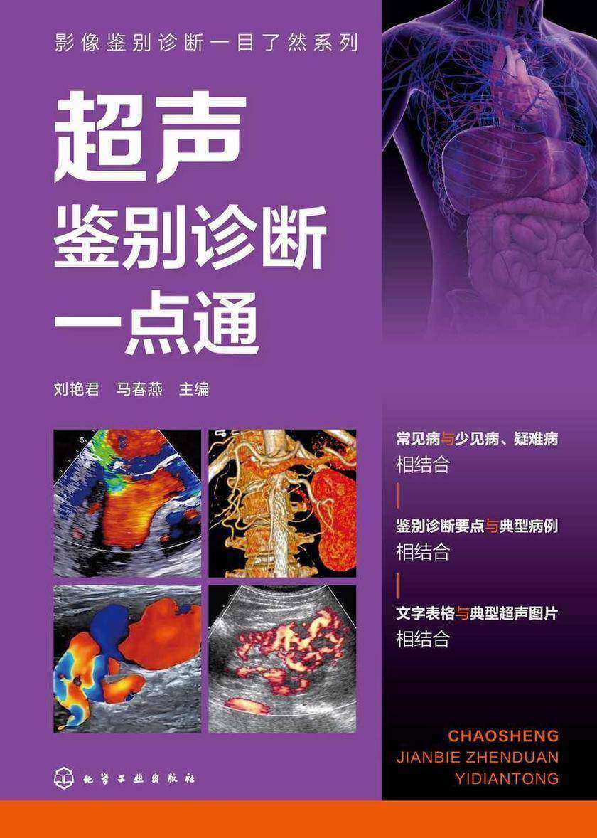 影像鉴别诊断一目了然系列--超声鉴别诊断一点通