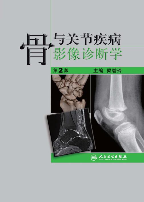 骨与关节疾病影像诊断学(第2版)