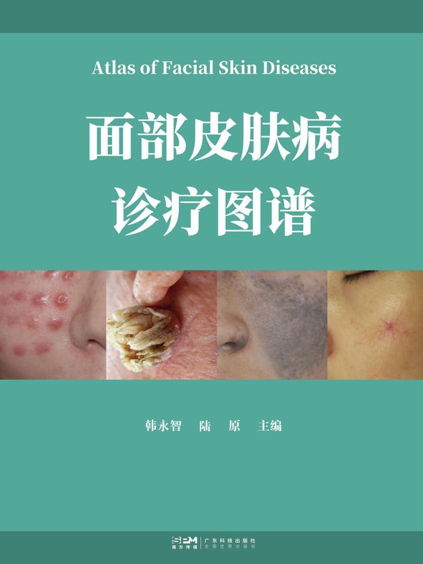 面部皮肤病诊疗图谱