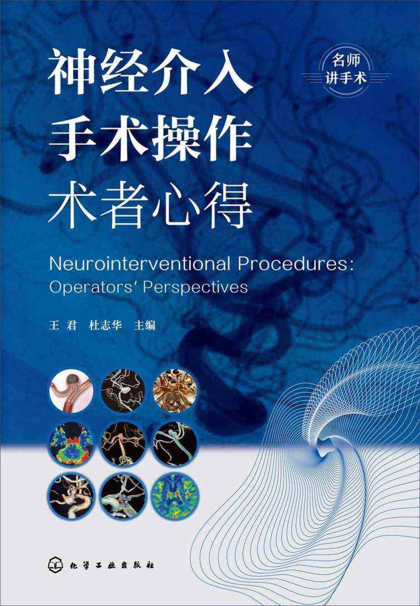 神经介入手术操作术者心得