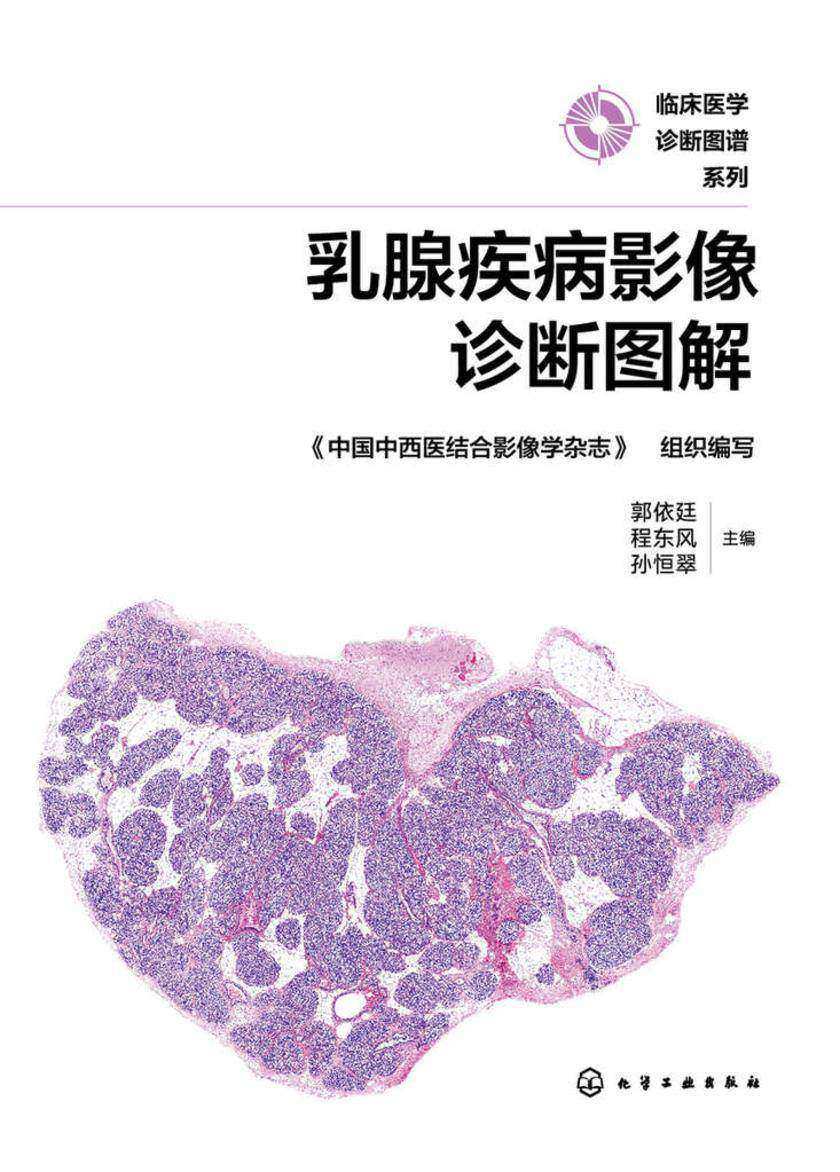乳腺疾病影像诊断图解